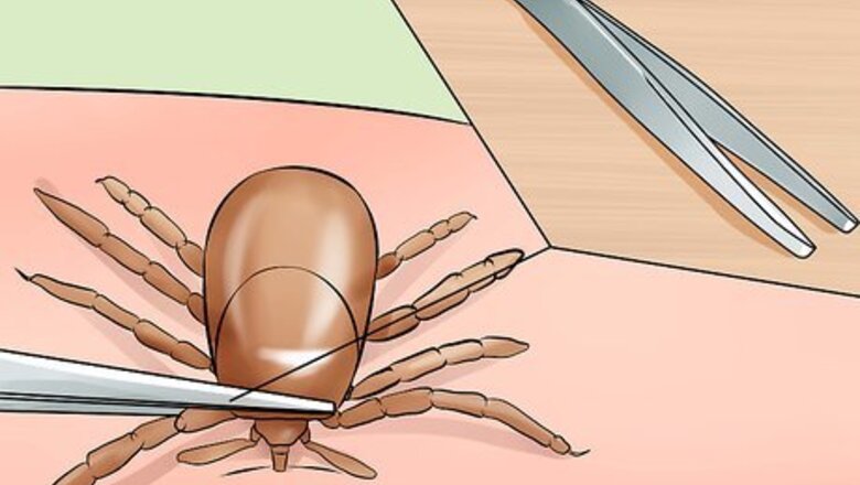 How to Treat Tick Bites