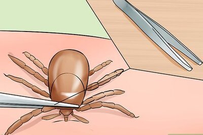 How to Treat Tick Bites