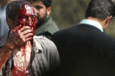 First Pics: Suicide bomber targets Indian Embassy in Kabul