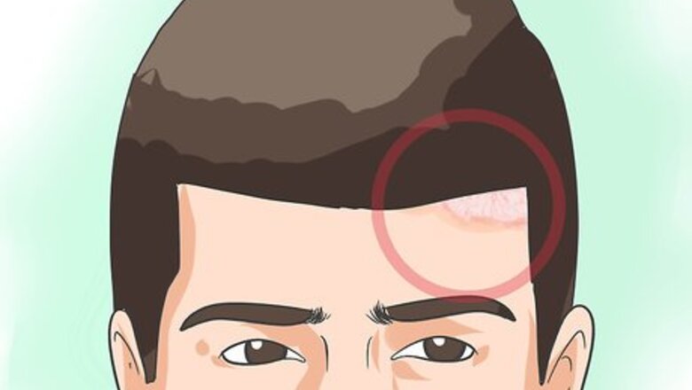 How to Diagnose Psoriasis