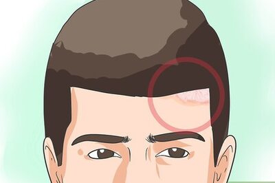 How to Diagnose Psoriasis