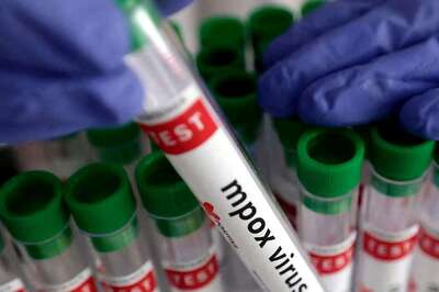 Suspected Mpox Infection Reported from Malappuram in Kerala, Samples Sent for Testing